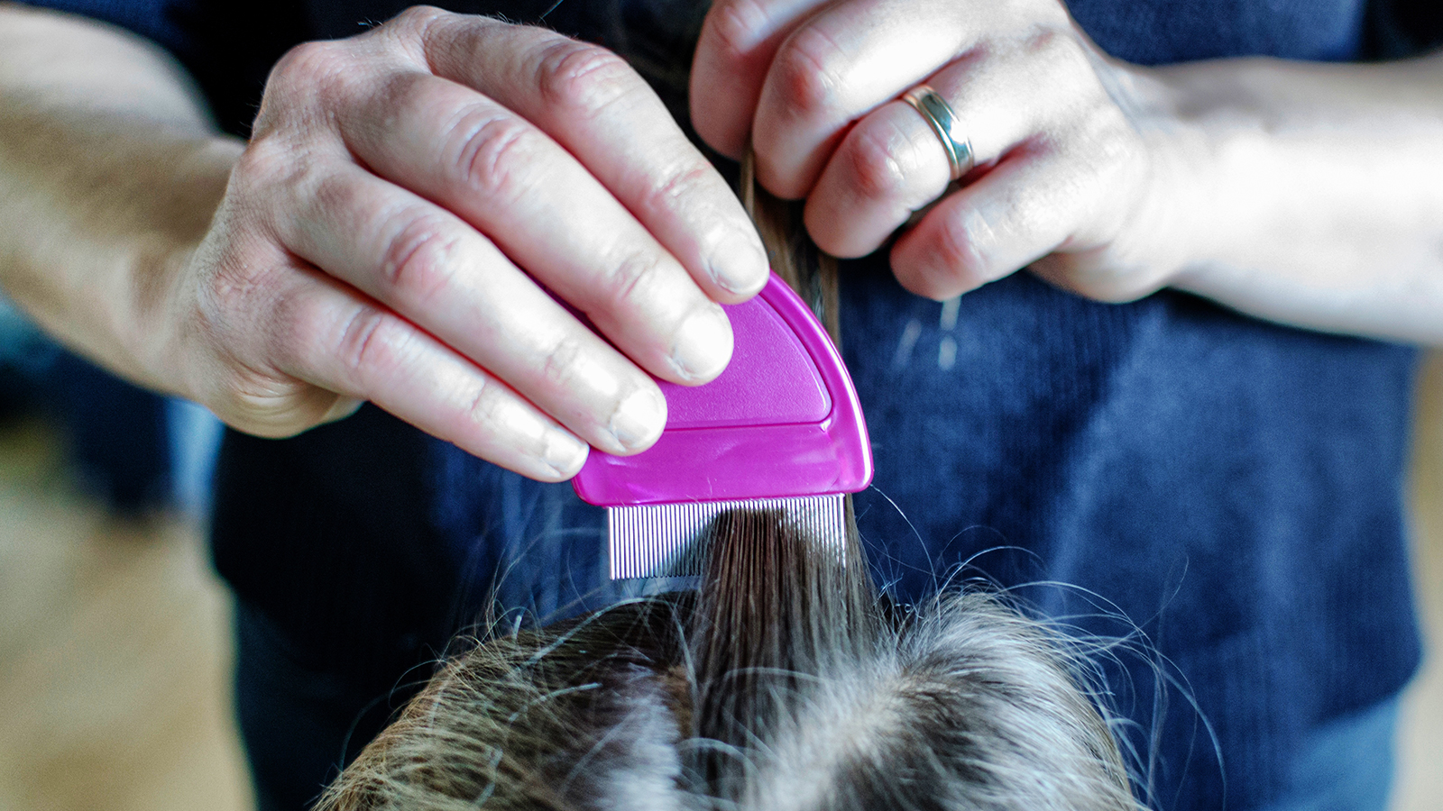 How to get rid of head lice permanently - Mingara
